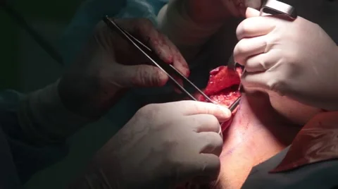 Doctor makes the operation facelift 스톡 동영상 68130162