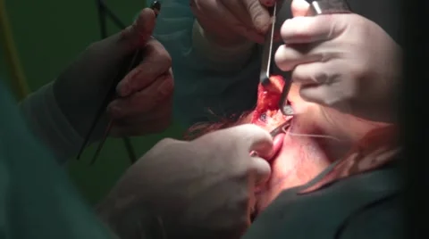 Doctor makes the operation facelift Stock-Footage 68130862