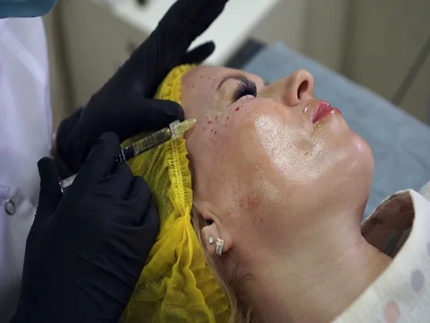 Doctor makes a skin prick for a middle-aged woman using a cannula needle for Video stock 77630375