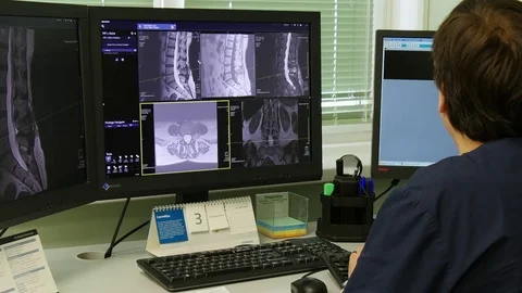 Doctor makes spinal cord and spinal colu... | Stock Video | Pond5