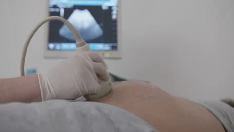 Doctor making does Ultrasound, Sonogram Procedure to a Pregnant Woman. Closeup Stock Footage 131120401