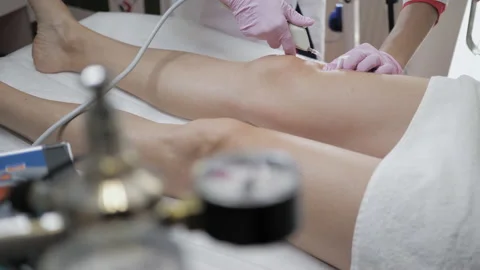 Doctor is making injection of carbon dioxide in patient's leg on carboxytherapy Video stock 150660694