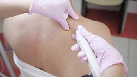 Doctor is making injection of carbon dioxide carboxy therapy. Skin rejuvenation Stock-Footage 150660754