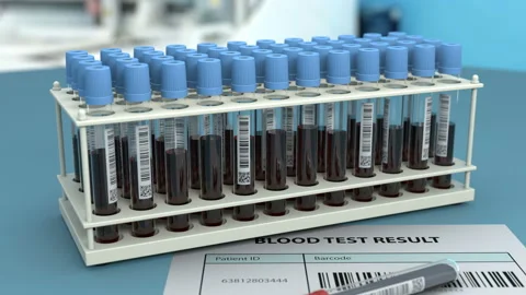 Doctor marks the blood sample test as positive Stock Footage 128571647