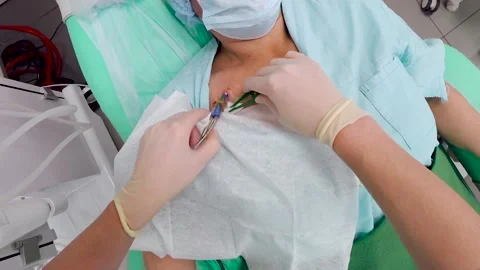 A doctor in medical gloves handles the wound, the place where the dialysis Stock Footage
