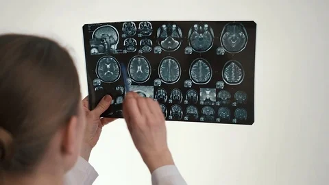 Doctor with MRI scan Stock Footage 72814075