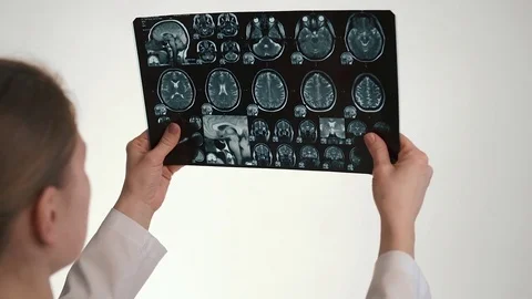 Doctor with MRI scan Stock Footage 72814088
