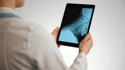 Doctor with neck x-ray Stock Footage 73315225