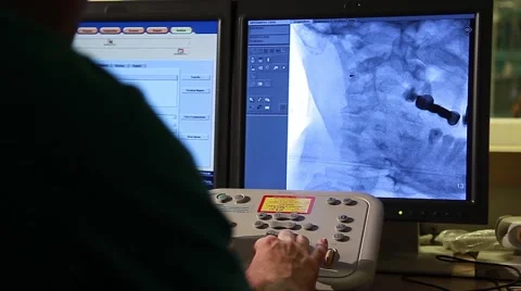 Doctor operating angiography machine Video stock 41531268