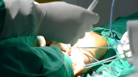 Doctor operating on leg Stock Footage 102781605