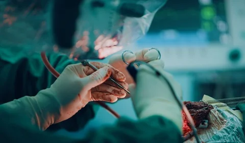 The doctor is operating in the operating room Craniotomy Stock Footage 125652665
