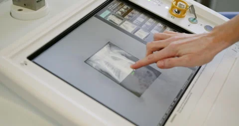 Doctor operating X-ray machine in medical setting Stock Footage 290763352