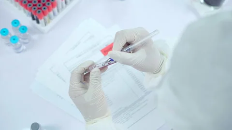 Doctor or Scientist checking sampling blood tube to make a medical diagnosis. Stock Footage 147254134