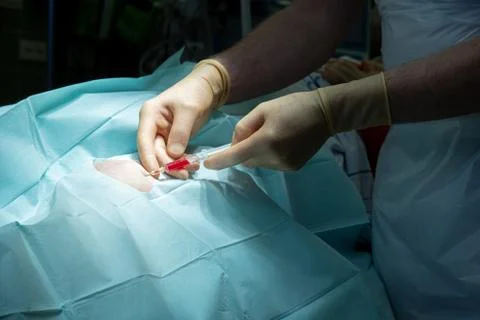 Doctor performs a knee puncture in an operating room with a cannula and a syr Stock Photos