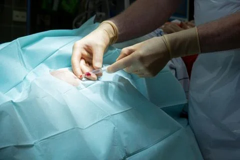 Doctor performs a knee puncture in an operating room with a cannula and a syr Stock Photos