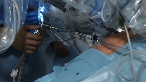 Doctor performs laparoscopic surgery using modern medical robot Stock Footage 242165540