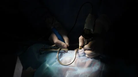 The doctor performs an operation on a child Stock Footage 155464532
