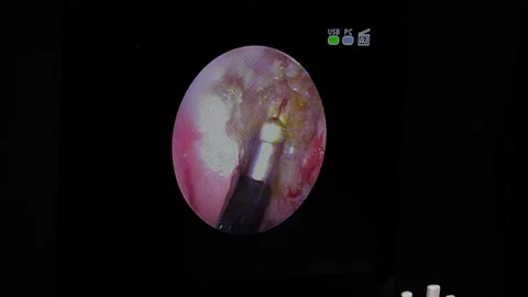 The doctor performs an operation on a child Stock Footage 155903487