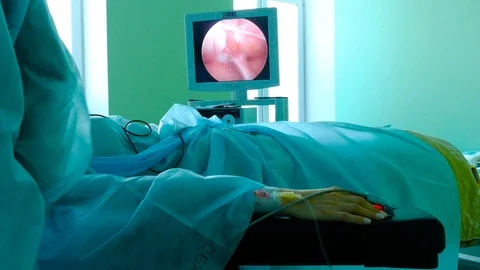 The doctor performs the operation with an endoscope. Stock Footage 113129154