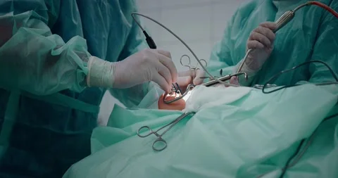 The doctor performs a pediatric surgical operation to remove the tonsils Stock Footage 163910223