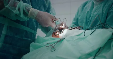 The doctor performs a pediatric surgical operation to remove the tonsils Stock Footage 163910566