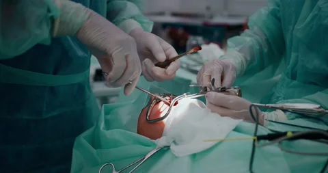 The doctor performs a pediatric surgical operation to remove the tonsils Stock Footage 163911334