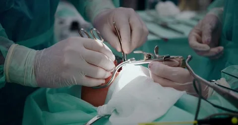 The doctor performs a pediatric surgical operation to remove the tonsils. Stock Footage 163912380