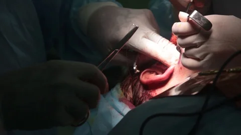 The doctor performs plastic surgery on the patient with a facelift Stock Footage 123569170