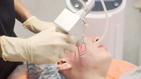 The doctor performs the procedure of lifting with a laser Stock Footage 144998613