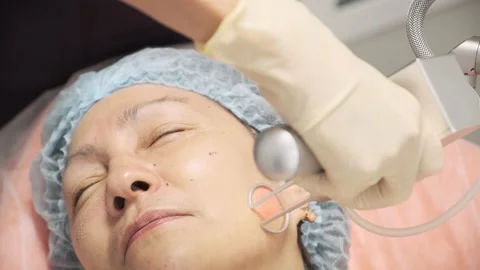 The doctor performs the procedure of lifting with a laser Stock Footage 145005960