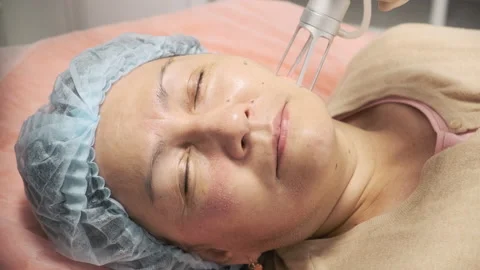 The doctor performs the procedure of lifting with a laser Stock Footage 145007319