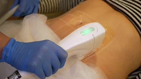 The doctor performs the smas lifting procedure Stock Footage 202607913