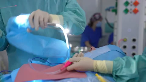 Doctor performs surgery with lighting equipment. Operation on a nose Stock Footage 164117540