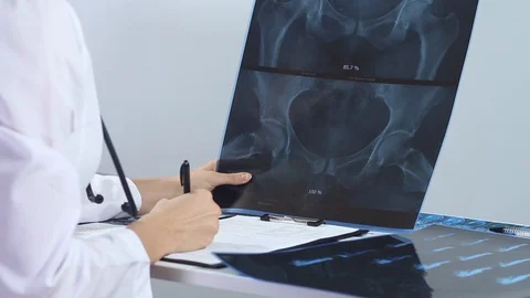 Doctor performs X-ray analysis in the hospital Stock Footage 86690253