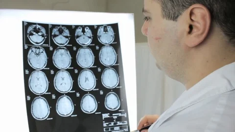 Doctor with pointer in hand describes MRI of the human brain Stock Footage 74240188