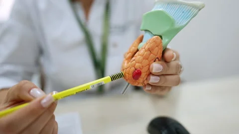 Doctor pointing at a thyroid gland model. A close-up of a doctor's hand Stock Footage 321491020
