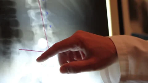 Doctor Points to X-Ray - Close Up Видео 26887853