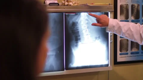 Doctor Points to X-Ray - Rack Focus 스톡 동영상 26886642