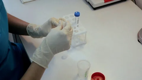 A doctor prepares a semen sample Stock Footage 76364322