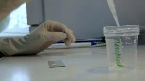 A doctor prepares a semen sample Stock Footage 76364579