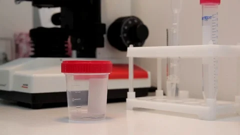 A doctor prepares a semen sample Stock Footage 76365351