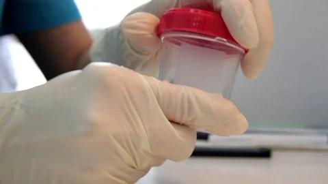 A doctor prepares a semen sample Stock Footage 76365414