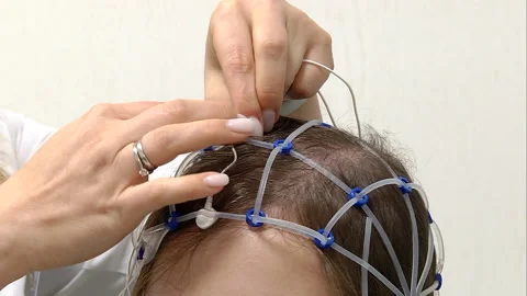 Doctor preparing sensor to procedure Stock Footage 160363361