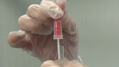 Doctor Preparing Specimen Collector For Testing In The Lab Stock Footage 320138538
