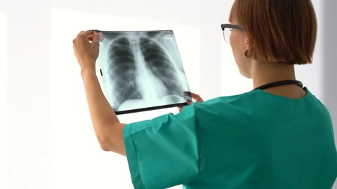Doctor professional radiologist checking, analyzing lung X ray. Spbas Woman Stock Footage 141836978