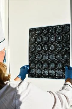 Doctor in protecting gloves holding brain MRI in medical office. MRI scan of  Stock Photos