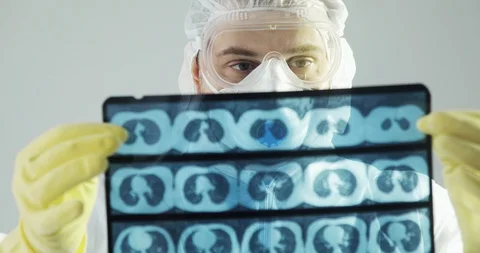 Doctor in protective clothes learning brain CT scan x-ray image on covid-19. Video stock 126640349