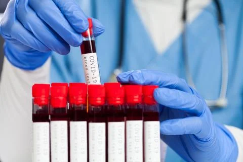 Doctor pulling out a red test tube with Coronavirus patient blood sample read Stock Photos
