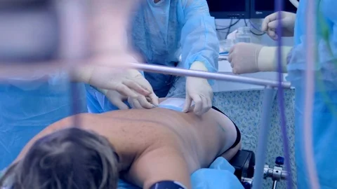 Doctor put bandage on a patients back after surgery. Stock Footage