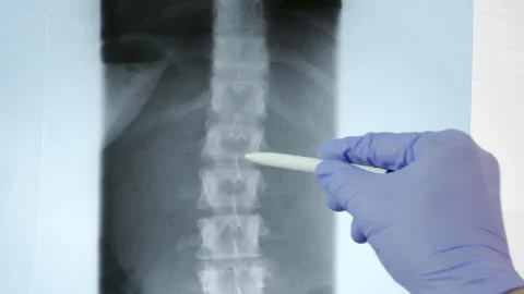 Doctor radiologically analyzing the spinal column Vidéo 286233499